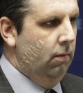 n this Tuesday, March 10, 2015, file photo, U.S. Ambassador to South Korea Mark Lippert listens to a question during a press conference before being discharged from Severance Hospital in Seoul, South Korea. South Korean prosecutors on Wednesday, April 1, 2015, indicted Kim Ki-jong, 55, who slashed Lippert in Seoul last month on charges of attempted murder. (AP Photo/Ahn Young-joon, File)