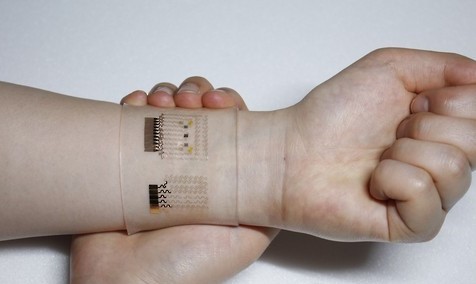 This photo provided by Seoul National University on March 22, 2016, shows a nanotechnology-based wearable device that a team of South Korean scientists have developed for more convenient diabetes monitoring and therapy. The graphene-using "smart patch" has improved the accuracy of blood sugar level measurements as it checks not only the glucose in sweat but also temperature and acidity, according to the Institute for Basic Science in Daejeon, some 160 kilometers south of Seoul. (Yonhap)